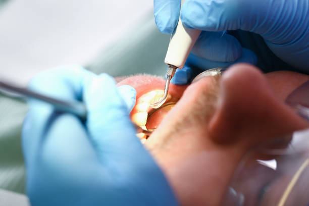 Best Urgent Care for Lost Fillings or Crowns in Spearman, TX