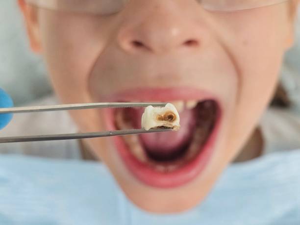 Best Same-Day Emergency Dental Services in Spearman, TX