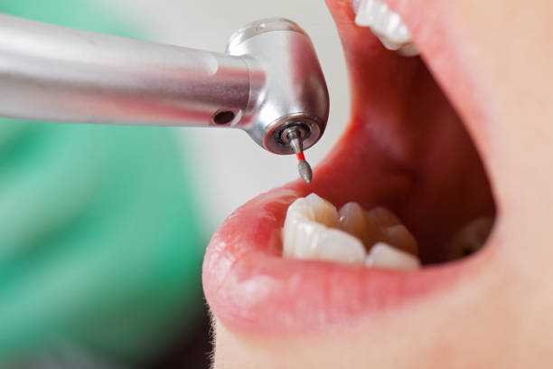 Best Emergency TMJ Treatment in Spearman, TX